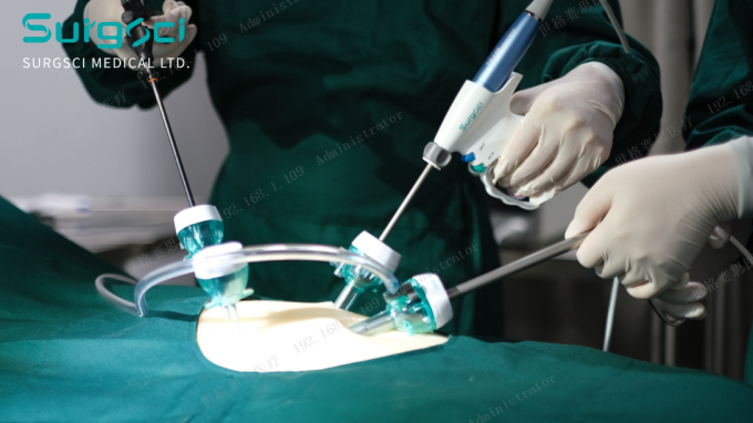 के बारे में नवीनतम कंपनी की खबर Trocar चीरा के लिए स्थान | सर्ग विज्ञान  0