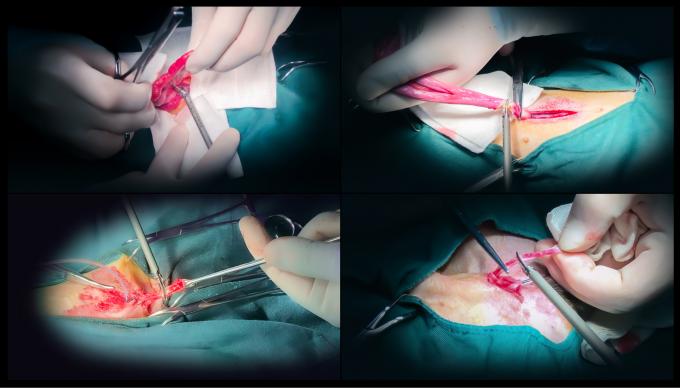 पशु चिकित्सा उपयोग के लिए लैप्रोस्कोप सर्जरी अल्ट्रासोनिक स्केलपेल सिस्टम हेमोस्टेसिस 6