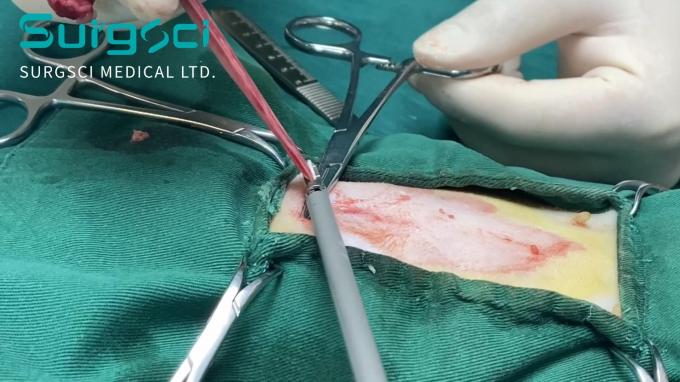 के बारे में नवीनतम कंपनी की खबर वेसल सीलिंग और लिगेशन के लिए अल्ट्रासोनिक वेटरनरी स्केलपेल | सर्ज विज्ञान  0