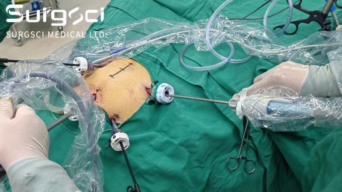 के बारे में नवीनतम कंपनी की खबर अपने देश में हमारे वितरक बनें।  0