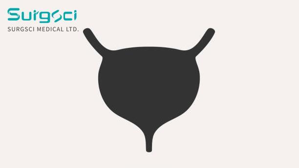 के बारे में नवीनतम कंपनी की खबर मूत्राशय क्षयरोग का नैदानिक वर्गीकरण  0